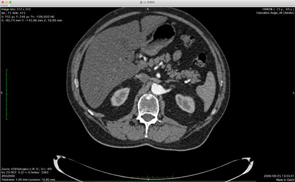 図4　胸部〜腹部におけるCTスキャンの画像例