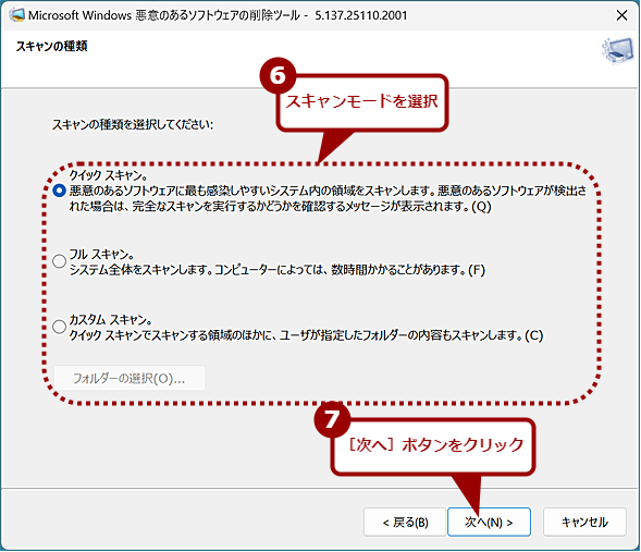 MRT�̎g�����i4�j