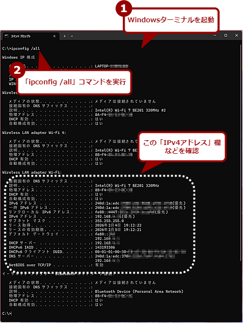 �uipconfig�v�R�}���h�Ńl�b�g���[�N�̏�Ԃ��m�F