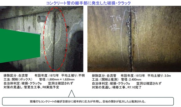 ͊wI㕔i\㉞͂W₷ӏȂǁjŋً}xIɔ肳ꂽBRN[gǂ̌p蕔ɔjNbN