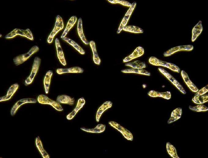 ミドリムシが、この5年で6倍も売れたワケ：水曜インタビュー劇場