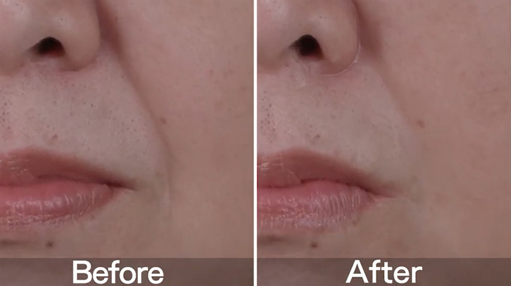 花王 ほうれい線 を目立たなくする化粧技術を開発 塗るだけで頬のたるみを持ち上げる 最適なポリマーを発見 Itmedia ビジネスオンライン