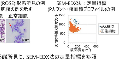 ������x����זE�f�̐V��͋Z�p�@SEM�ƌ��f���͂Ō��̕]�����x��