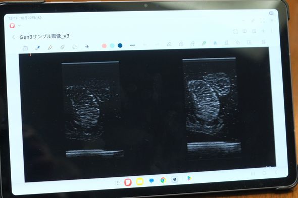 �f���p�ɂ݂���[���[���X�L���������摜�B�����O����i�A�E��viewphii-Gen3