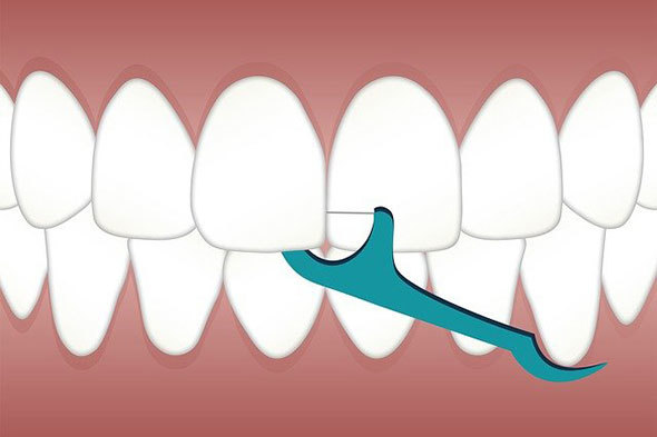 「歯間ケア」グッズおすすめ3選　歯間ブラシやデンタルフロスで歯周病予防