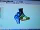 インプラント設計などに有用、3D人体モデルの作成/解析ツール