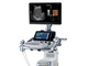 肝硬度測定と超音波検査に1台で対応する超音波診断装置を発売