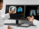 胸部CT画像が対象のAI技術による解析サービスのトライアルを提供