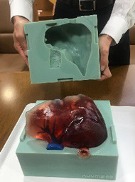 デジタルモールドで成形した肝臓のモデル