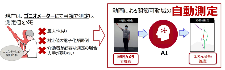 リハビリ動画から自動で肩と肘の関節可動域を測定する