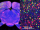 細胞100万個を同時観察できる光イメージング法を開発