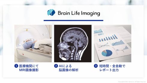 Splinkの「Brain Life Imaging」