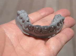 3Dプリンタで製造した歯型