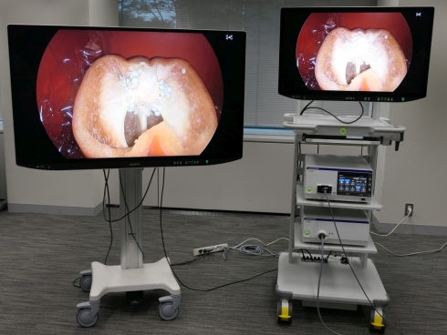 外科手術用内視鏡システムの新製品「VISERA ELITE III」