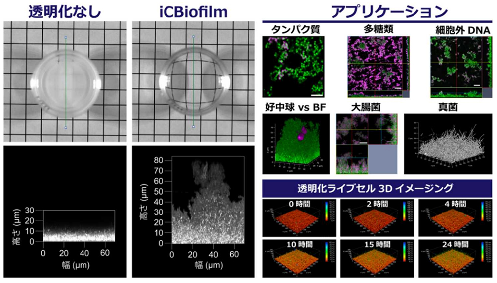 バイオフィルムを生きたまま内部まで観察できる透明化技術を開発：医療技術ニュース - MONOist