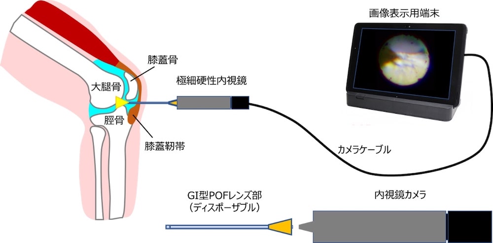注射針と同等サイズの極細ディスポーザブル内視鏡を開発：医療機器
