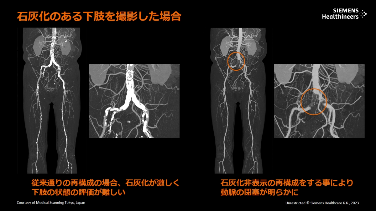 ΊD̂鉺BeꍇB@\C[WOɂĐΊD\̍č\sƂŁA̕ǁiւj炩ɂȂmNbNŊgn oFV[XwXPA