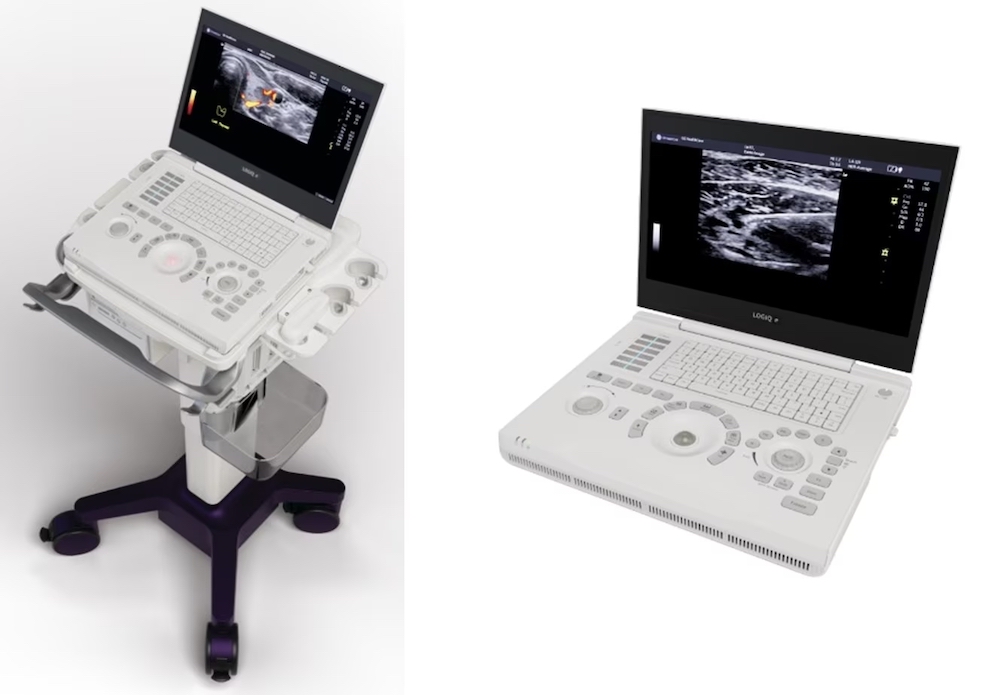 ポータビリティ性を高めたラップトップ型汎用超音波画像診断装置：医療機器ニュース - MONOist