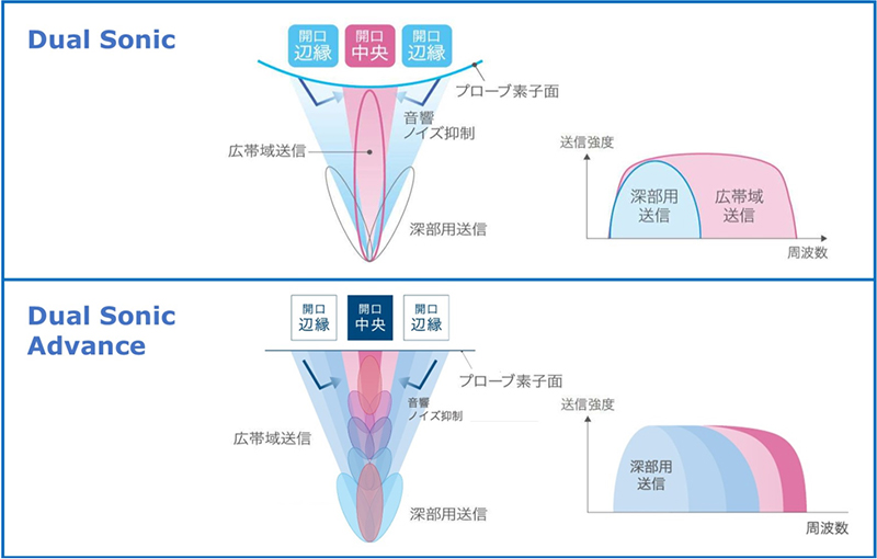 掿ZpuDual SonicvƁuDual Sonic Advancev̔rmNbNŊgn oFRjJ~m^