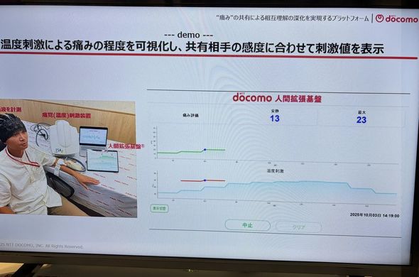  NTThR̒ɊovbgtH[BɊoixjhuɂɂ݂]g肵AlԊgՂl