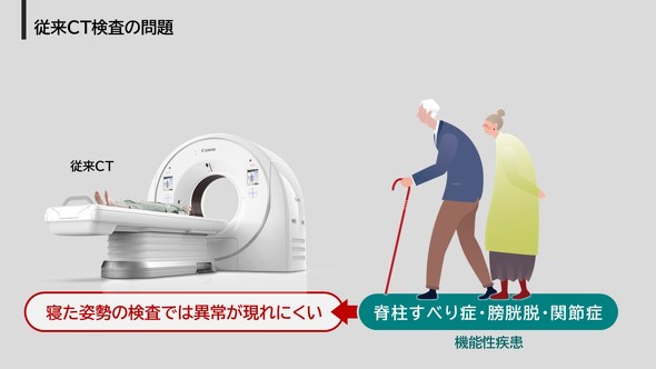 �]����CT�����ɂ�������_�ɂ���