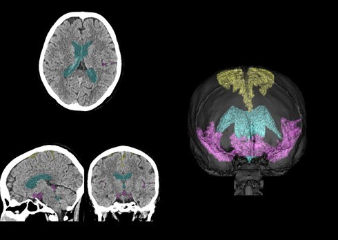 �L���v�V����