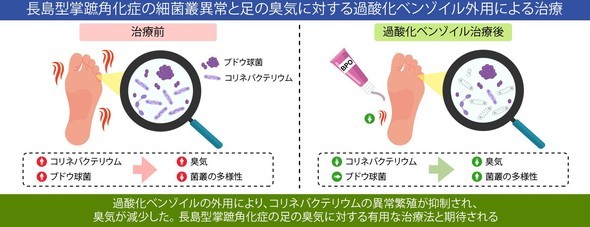 �L���v�V����