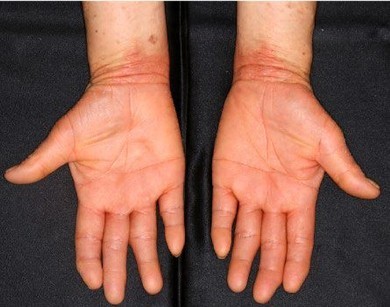 �L���v�V����