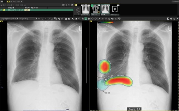 �L���v�V����