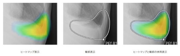 �L���v�V����