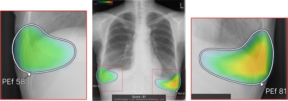 �L���v�V����