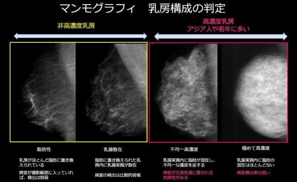 �L���v�V����