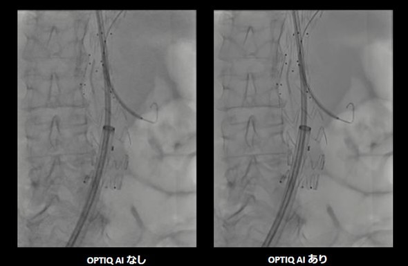 �L���v�V����