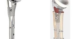 セメントを使わずに固定、高齢者の上腕骨折に向けた人工肩関節：医療