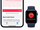 Apple Watchで心肺機能の通知が受信可能に　watchOS 7.2で