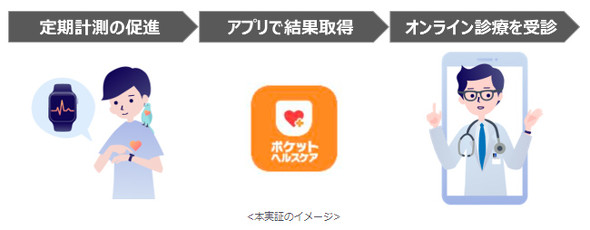 Apple WatchをAFibに使用する方法