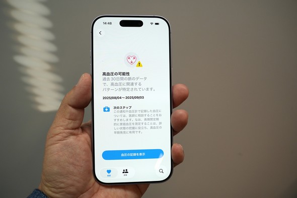 高血圧パターンの通知