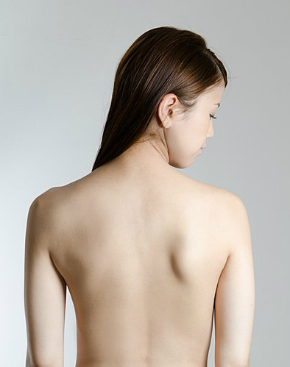 背中 の 痛み 右側 肩 甲骨 の 下