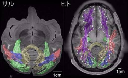 サルとヒトは視覚情報を伝える脳構造が似ている 136年前の古典的研究成果 最新のmri技術で証明 Itmedia News