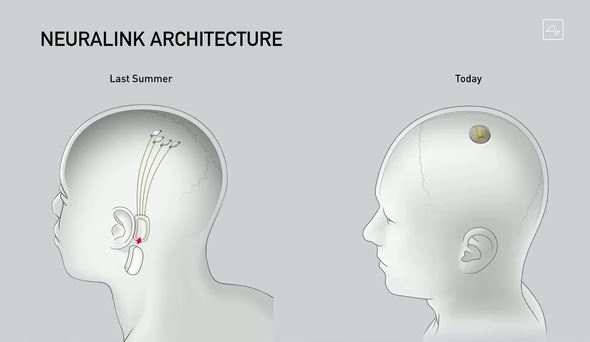 麻雀 ゲーム アプリk8 カジノAIに負けるな──イーロン・マスク「Neuralink」の狙いは「人類の能力の拡張」　脳を読み取る「ブレイン・マシン・インタフェース」開発の今仮想通貨カジノパチンコ甲賀 忍法 帖 2