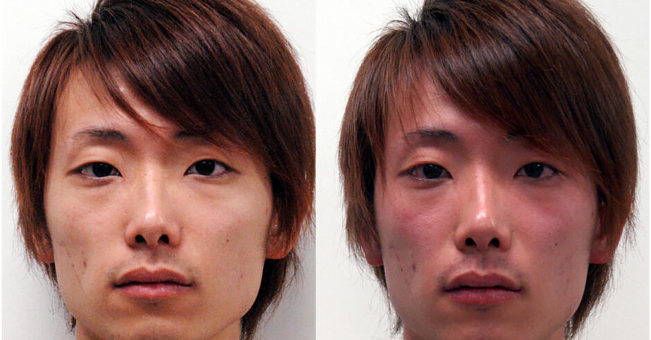 “酒を飲むと顔が赤くなる”体質は収入を左右する？　日本男性含む3000人を調査　東大などが2023年に学術誌で発表