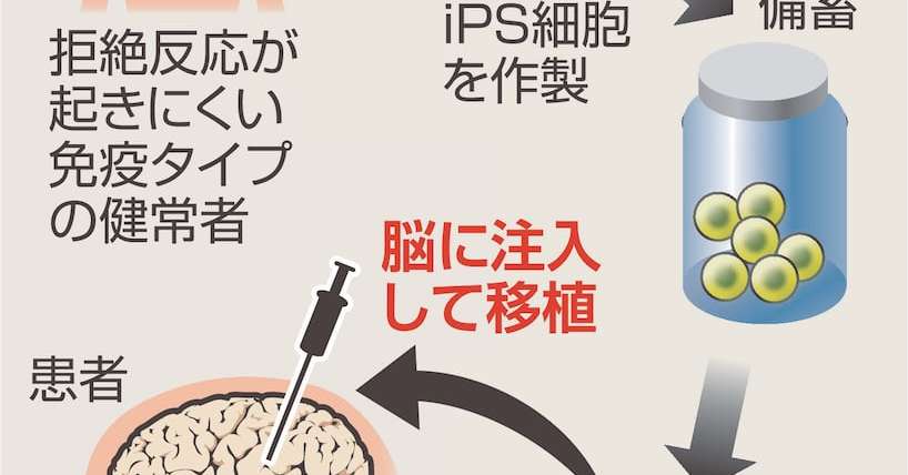 iPS細胞由来再生医療製品「アムセプリ」、保険適用へ　年内に実用化