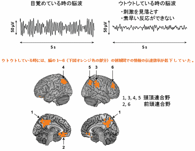 眠くなると頭の回転が鈍るのはなぜ 仕組みを解明 ねとらぼ