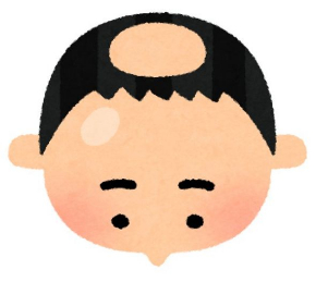 はげ イラストや 最高の画像壁紙ihd