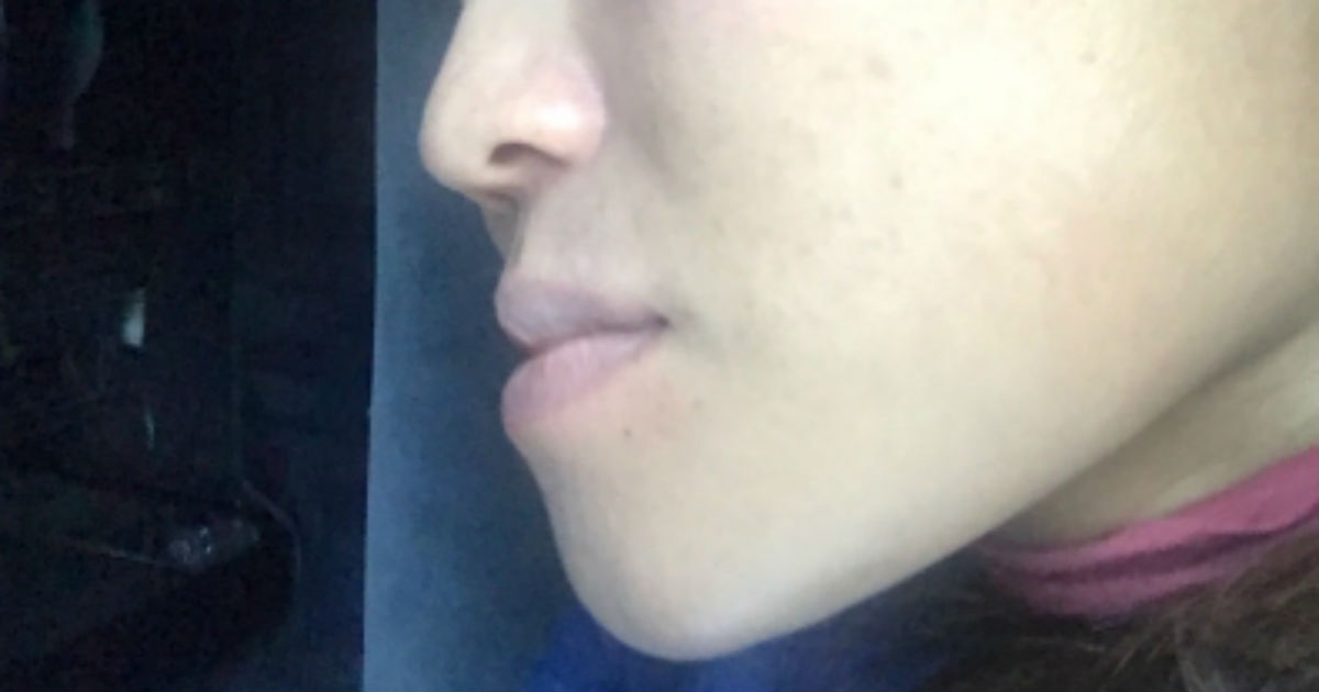 まさかの職業病 キンタロー 変顔のやりすぎでアゴに異変 しゃくれ系ばかりやってたから ねとらぼ