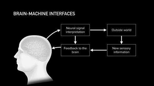 イーロン・マスクの「ニューラリンク」、脳埋め込みインタフェースを実用化へ　2020年に臨床試験
