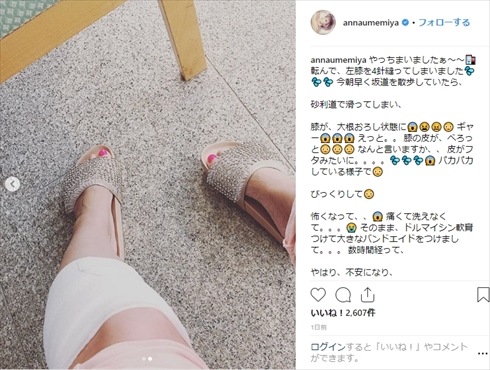 梅宮アンナ けが Instagram 病院 転倒