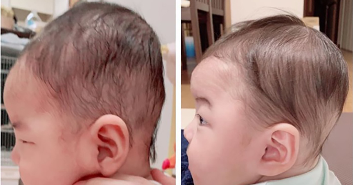 稲垣早希 0歳息子の ヘルメット治療 前後の姿を公開 頭部の形が大幅改善に 思い切ってやって良かった 1 2 ページ ねとらぼ