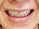 くわばたりえ、3年半に及ぶ矯正後の歯並びを公開　隙間なくきれいに直った歯を見せ「真っ直ぐになってきました！」