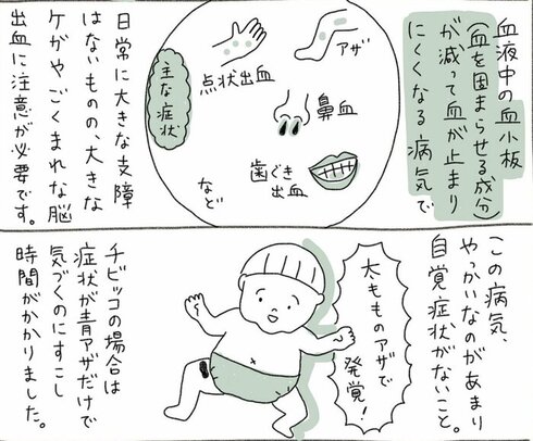 子どもが青アザで入院した 実体験漫画に反響 病名が分かるまでの不安や入院治療のつらさに共感の声 1 2 ページ ねとらぼ